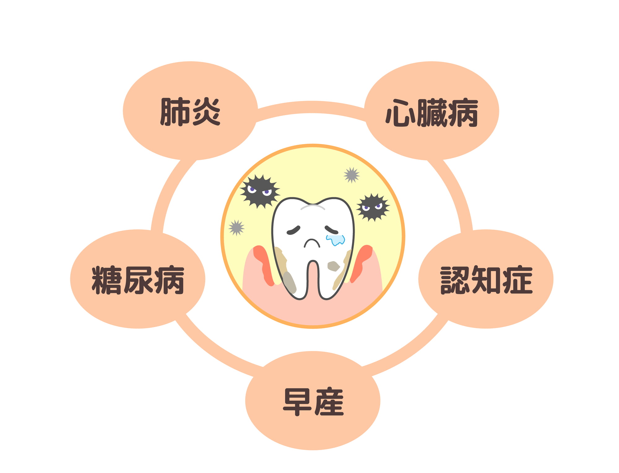 歯周病の歯のイラストを取り囲む糖尿病や心臓病などの病名